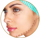 Facelift Surgery specialist